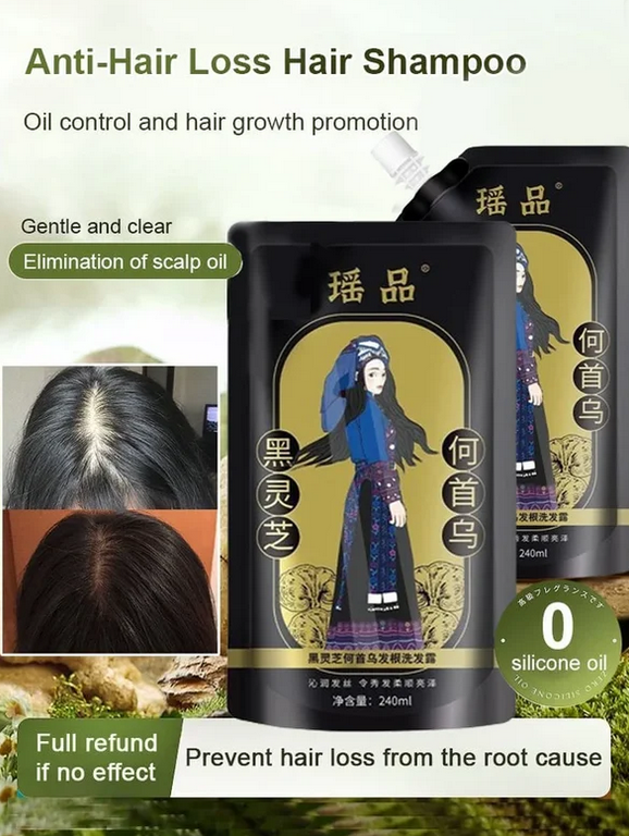 ✨Last Day Promotio🎁Hot Sale Ginger Plant Extract Anti-Hair Loss Hair Shampoo