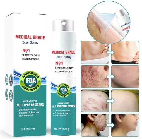 ❤️Advanced Scar Spray For All Types of Scars - For example Acne Scars, Surgical Scars and Stretch Marks ⚡️⚡️⚡️
