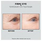 🎁49% OFF🎁FIRM Eye Tightener