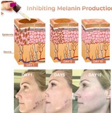 ✨Fast Dark Spot Remover-NESLEMY™ Melanin Correcting Facial Serum