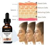 ✨Fast Dark Spot Remover-NESLEMY™ Melanin Correcting Facial Serum