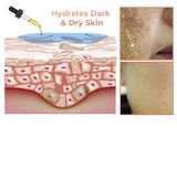 ✨Fast Dark Spot Remover-NESLEMY™ Melanin Correcting Facial Serum