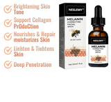 ✨Fast Dark Spot Remover-NESLEMY™ Melanin Correcting Facial Serum